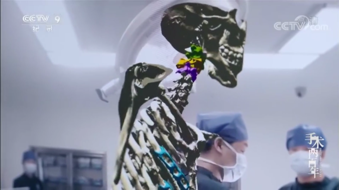 混合現(xiàn)實手術(shù)紀(jì)錄片